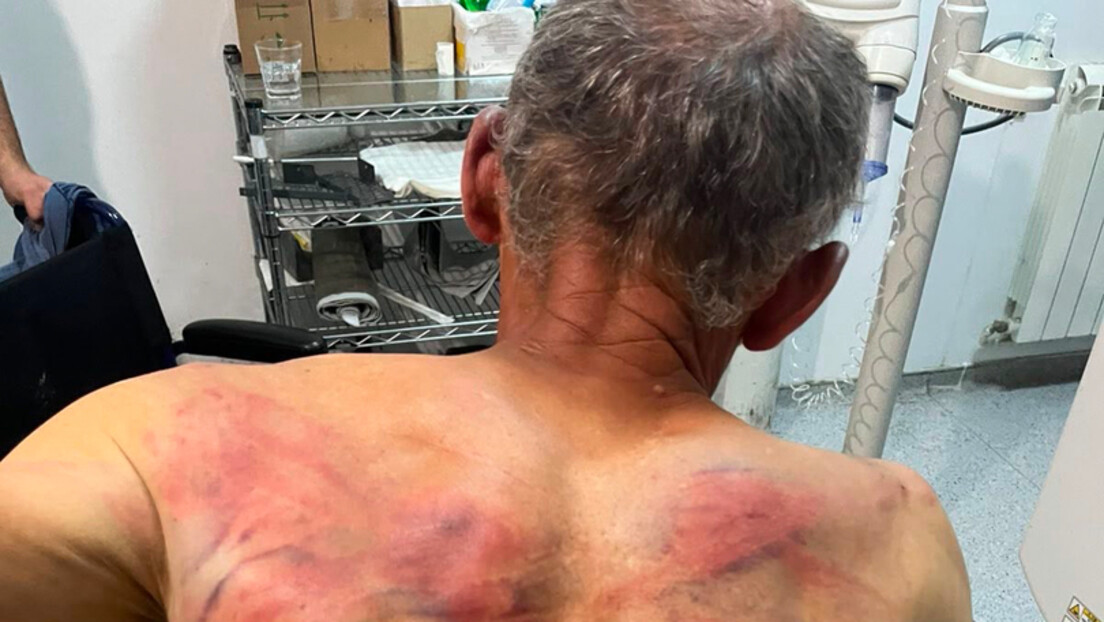 Српска листа о мучењу Србина на КиМ: Суспензија полицајаца није довољна, морају на суд