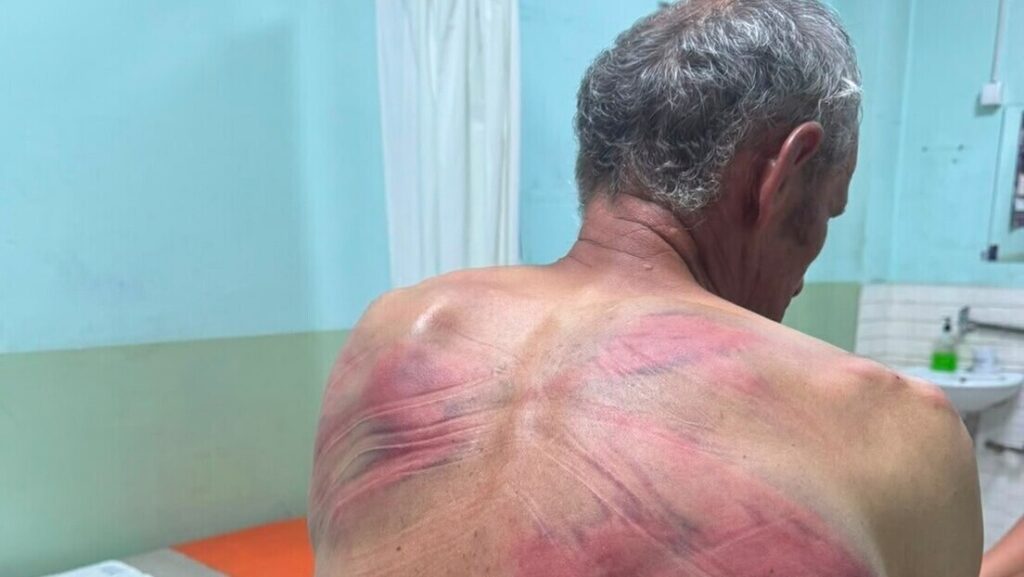 Српска листа: За пребијање Срба од стране тзв. косовске полиције нема стварних последица