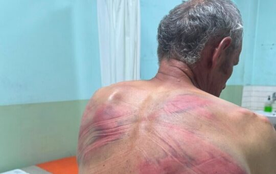 Српска листа: За пребијање Срба од стране тзв. косовске полиције нема стварних последица