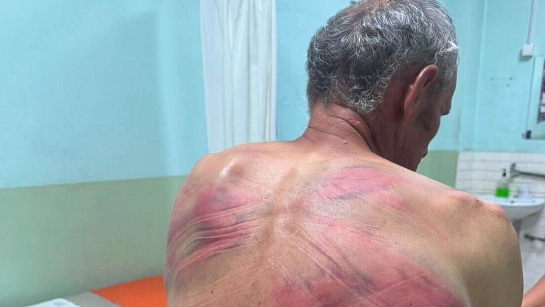 Српска листа: За пребијање Срба од стране тзв. косовске полиције нема стварних последица